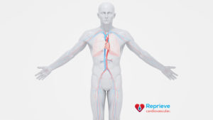 Reprieve Cardiovascular: Guided Diuretic Therapy